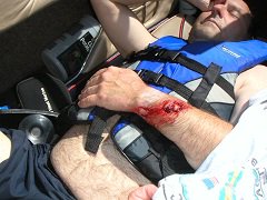 Bodily Injury What you need to know